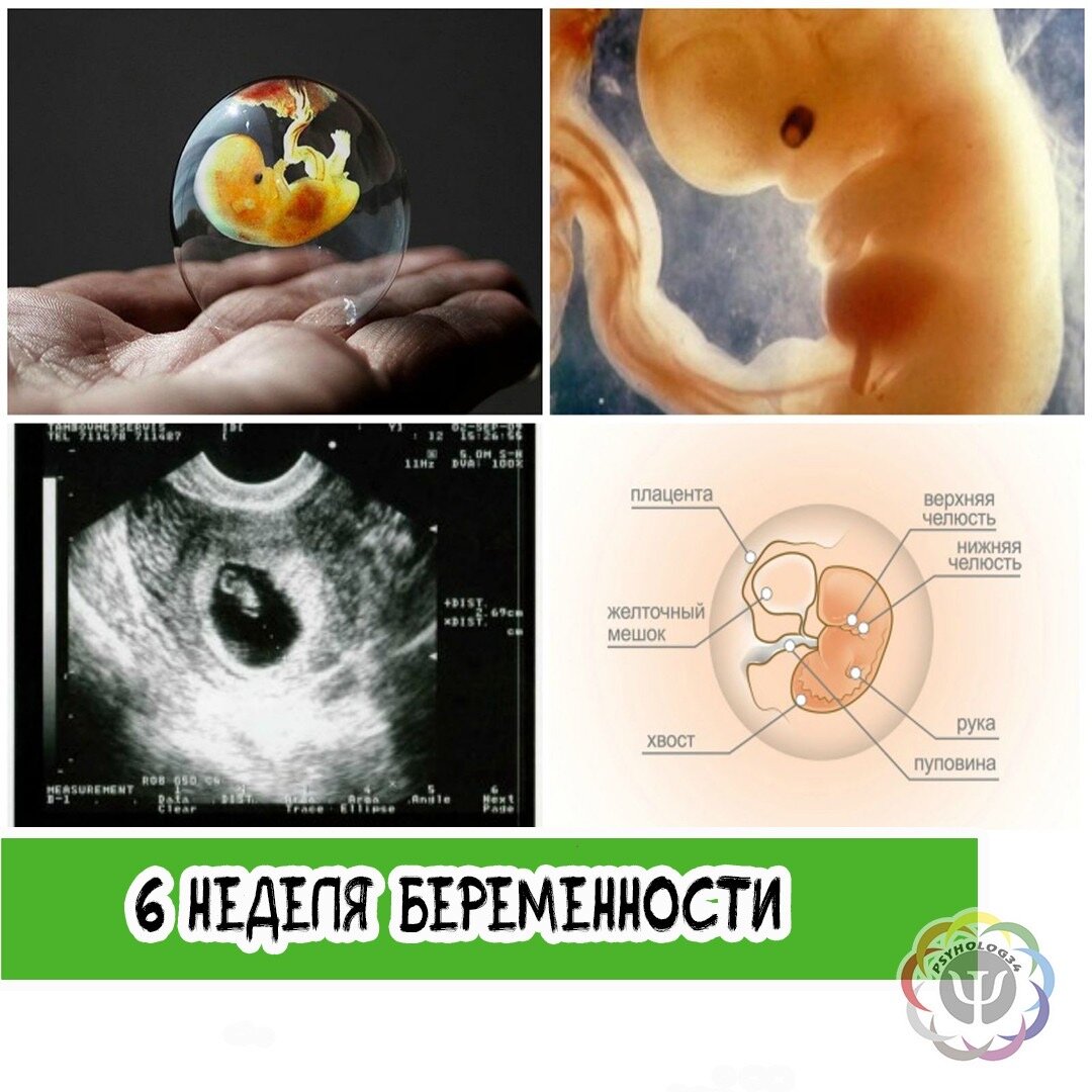 Картинки 5 недель беременности