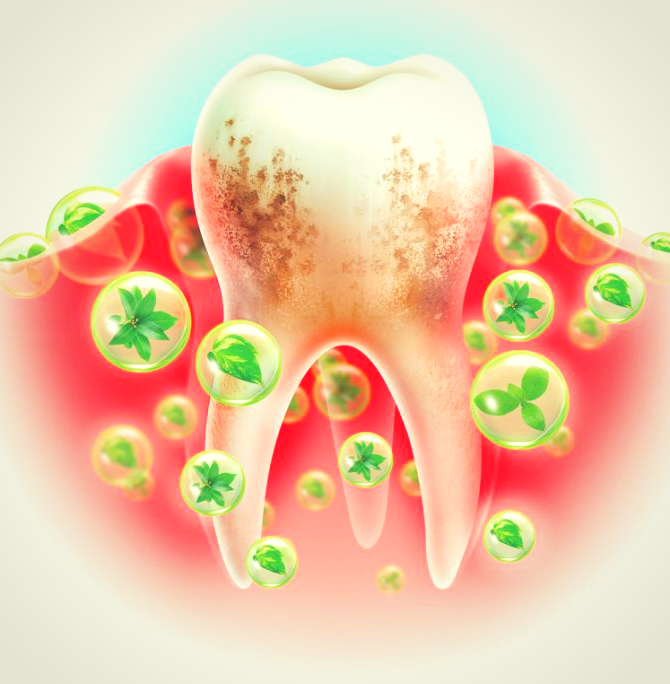 Рисунок 1-Пародонтит