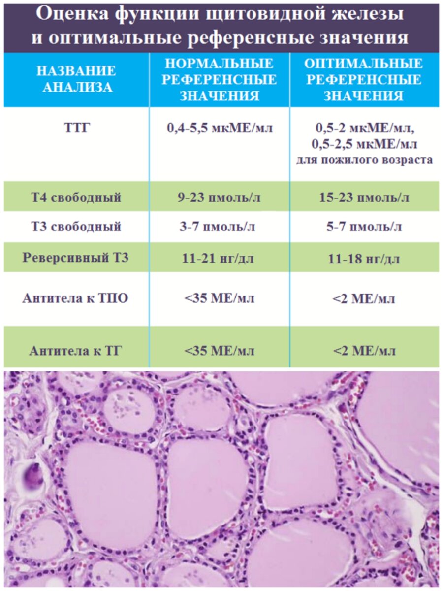 Гистологическое строение щитовидной железы