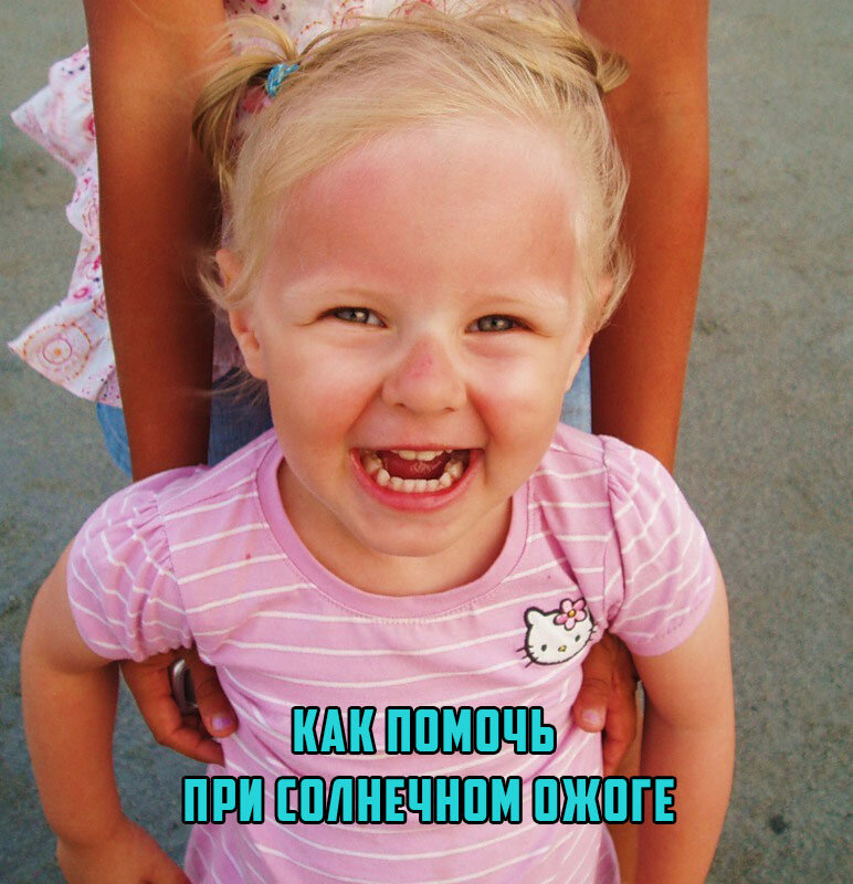 Как оказывать первую помощь при солнечном ожоге