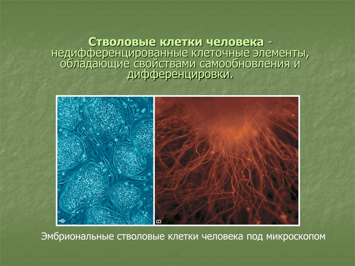 Полипотентные мезенхимальные стволовые клетки. Мезенхимальные стромальные стволовые клетки. Фетальные стволовые клетки под микроскопом. Мезенхимальные стволовые клетки под микроскопом.