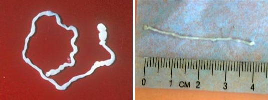 Спирометра Этот ленточный червь родом из Азии по идее должен инфицировать тела плотоядных животных, таких как кошки, собаки, а не людей.