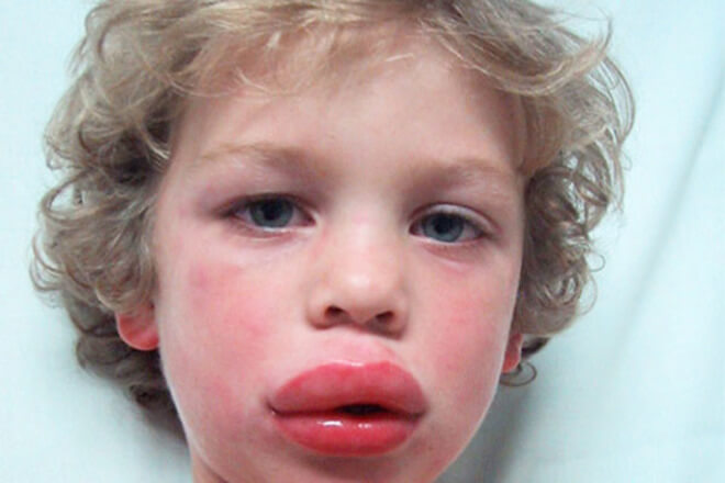 Примерно как у Коли. 