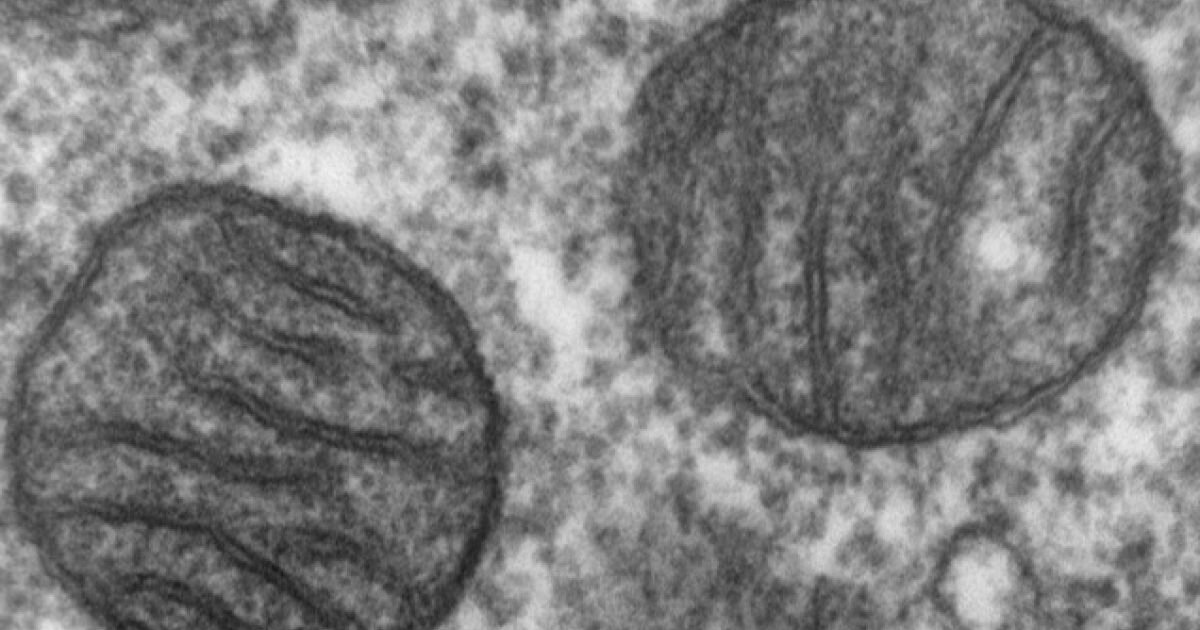 Обычная электронная микрофотография