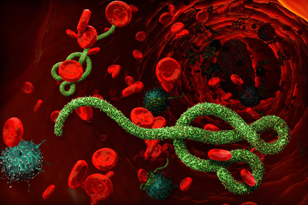Самая опасная инфекция. Бактерия лихорадки Эбола. Вирус Эбола под микроскопом. Геморрагическая лихорадка Эбола возбудитель.