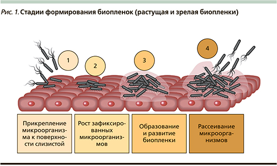 Биопленки кандиды. Биопленки в кишечнике. Стадии биопленки. Формирование биопленки. Этапы формирования биопленки.