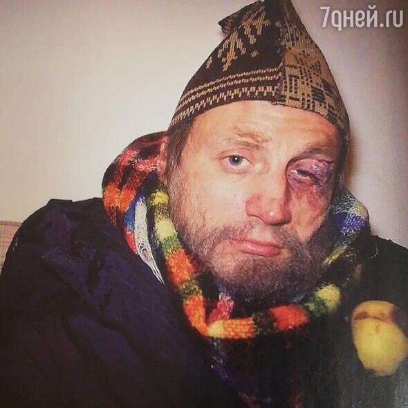    Анатолий Белый Соцсети