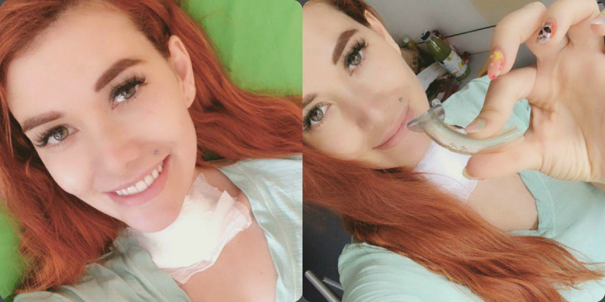 Николь Кузнецова демонстрирует трубку, без которой ранее не могла дышать