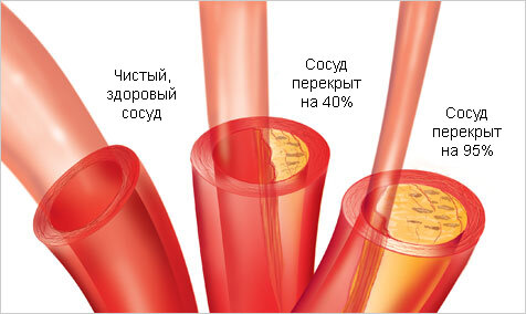 Источник фото: https://analiz-diagnostika.ru