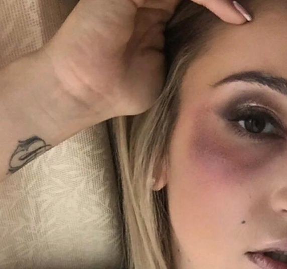 -2