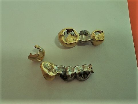 Золотые зубы продать. Сколько в среднем весит золотой зуб. Золотые зубы продать. Как сделать бутафорский золотой зуб. Коронки 850 проба золотые.