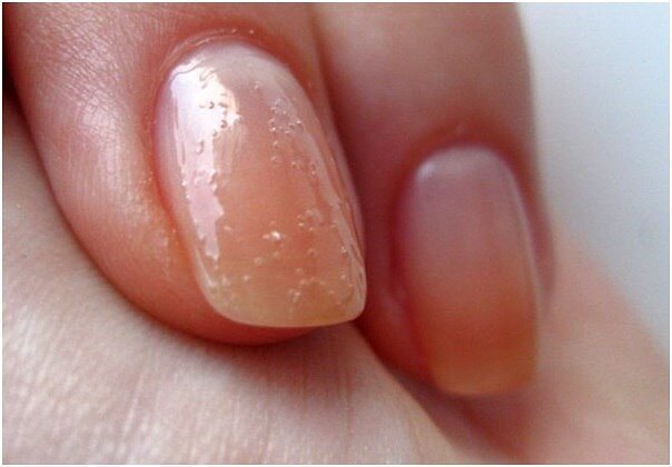 Почему пузырится гель лак на ногтях?