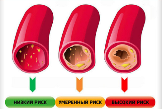 фото: https://budzdorovoy.ru