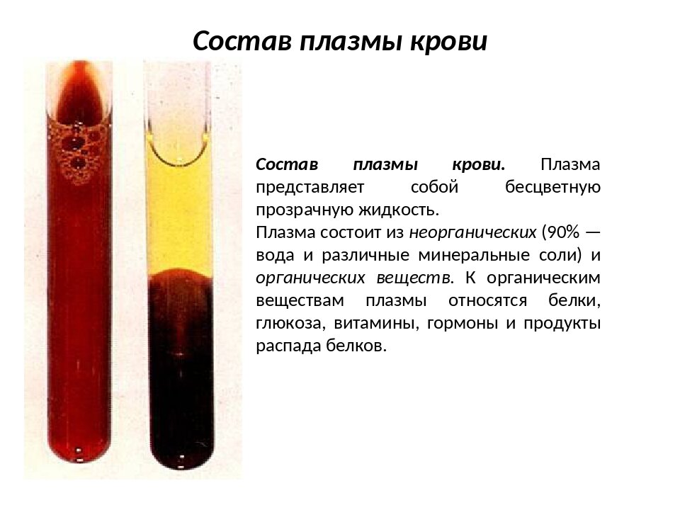 Иктеричность образца крови