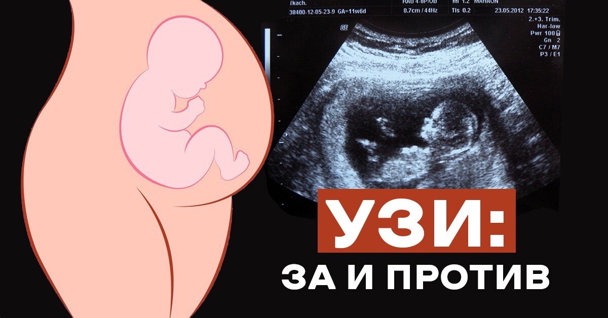 опасно ли узи при беременности. беременная на узи. узи скрининг. опасно ли узи при беременности. ультразвуковое исследование плода.