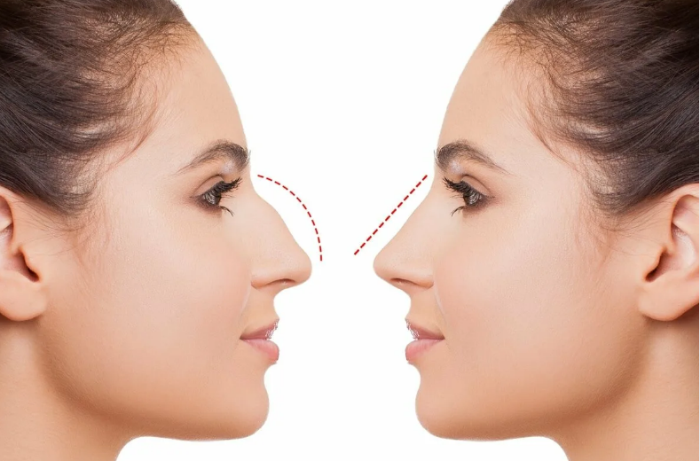 Фотография взята из источника cosmetic-clinic.ru