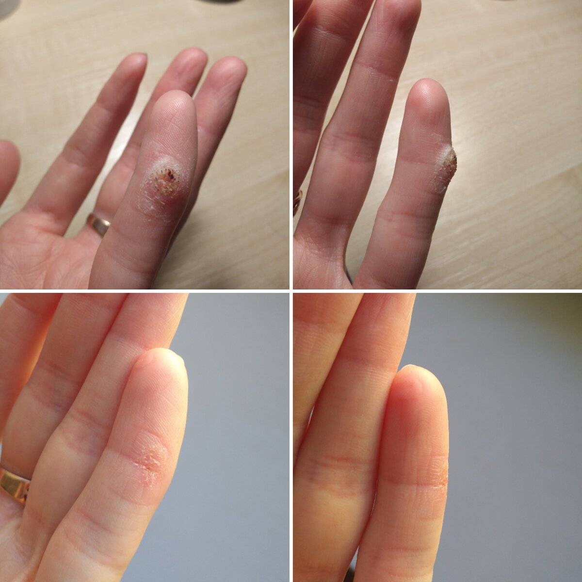 Разница между фото 10 дней