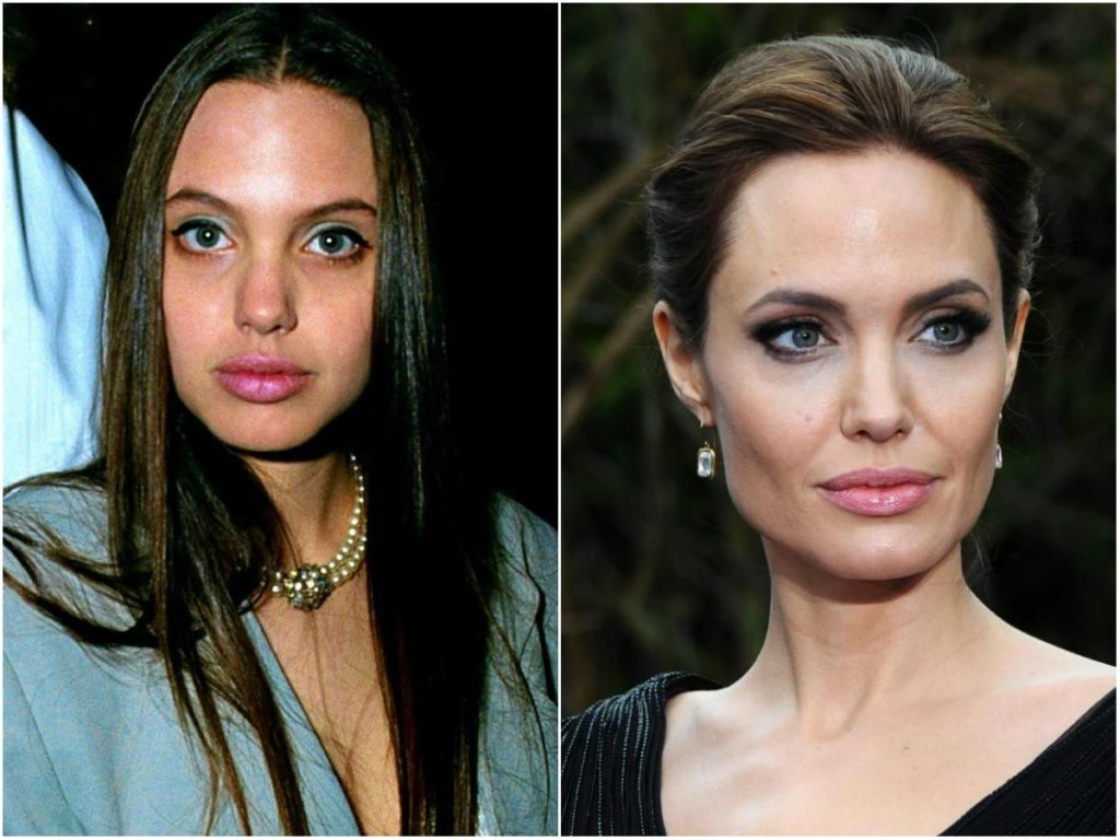 Звезды после нового. Анджелина Джоли ринопластика. Анджелина Джоли до пластики. Анжелина Джоли до и после пластики. Анджелина Джоли до операции и после.