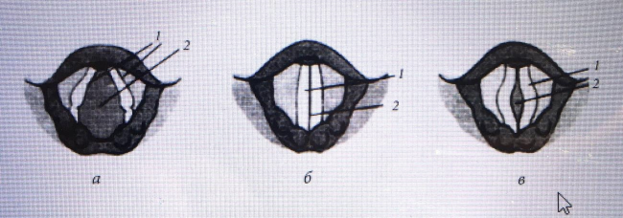 Положение голосовых связок а) при молчании, б) при разговоре, в) при шепоте                1. Голосовые связки, 2. Голосовая щель. 
