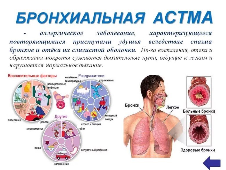 Бронхиальная астма: почему больных в мире становиться больше?