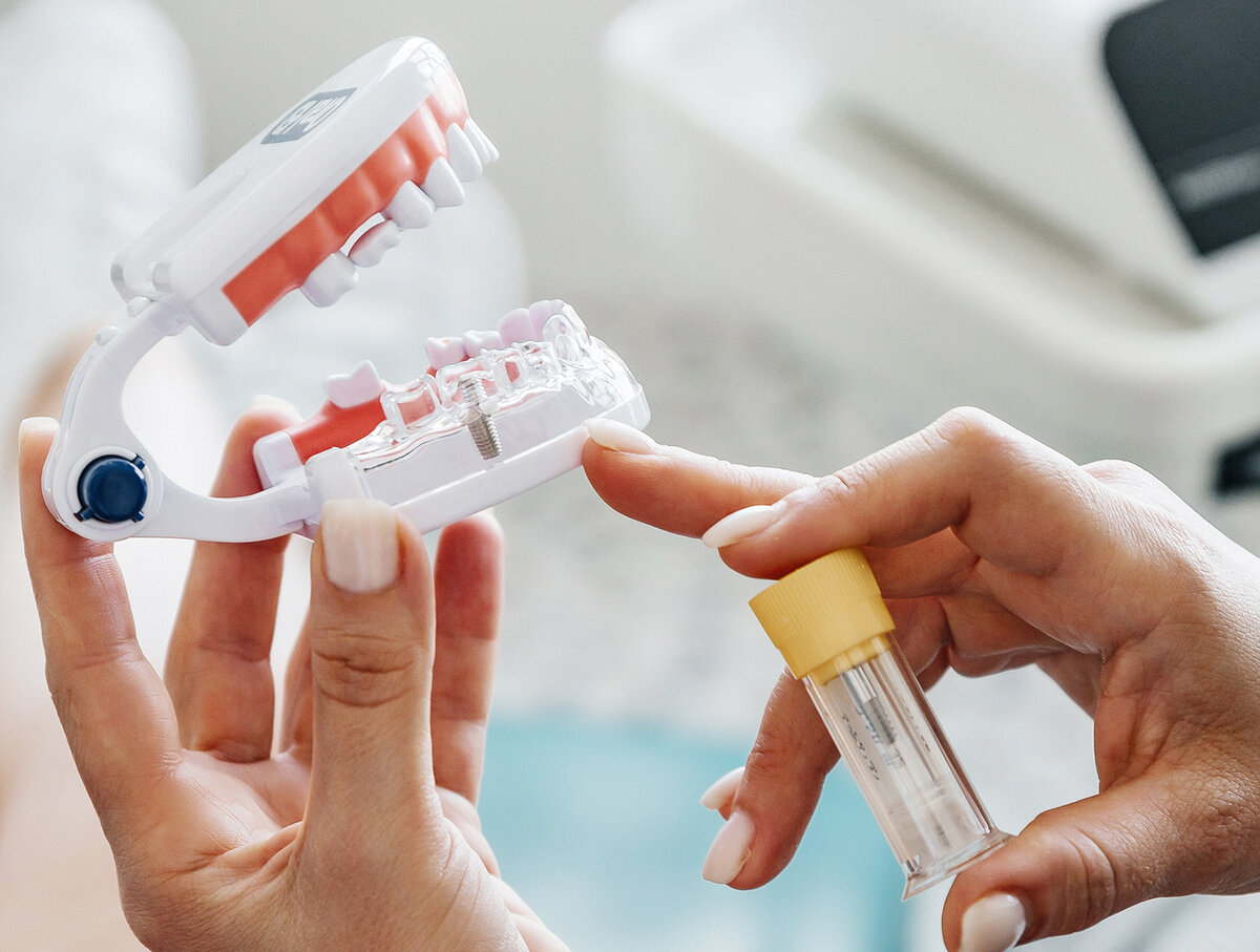 Положение имплантации в челюсти.