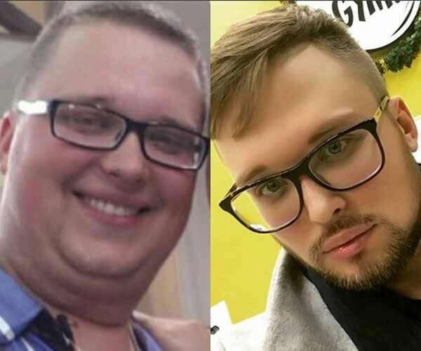 Егор халявин до и после пластики Егор Халявин До И После Пластики Фото - Karevaphoto.ru