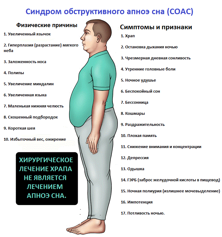 Тяжелое прерывистое дыхание. Синдром обструктивного апноэ. Синдром обструктивного апноэ сна. Синдром обструктивного апноэ сна симптомы. Синдром обструктивного ночного апноэ.