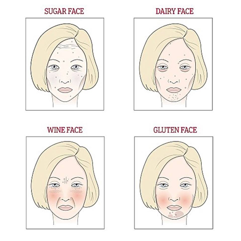 4-е типа лиц, которые выделила американская врач-натуропат Нигма Талиб: [по часовой стрелке] САХАРНОЕ лицо, МОЛОЧНОЕ лицо, БУЛОЧНОЕ лицо, ВИННОЕ лицо