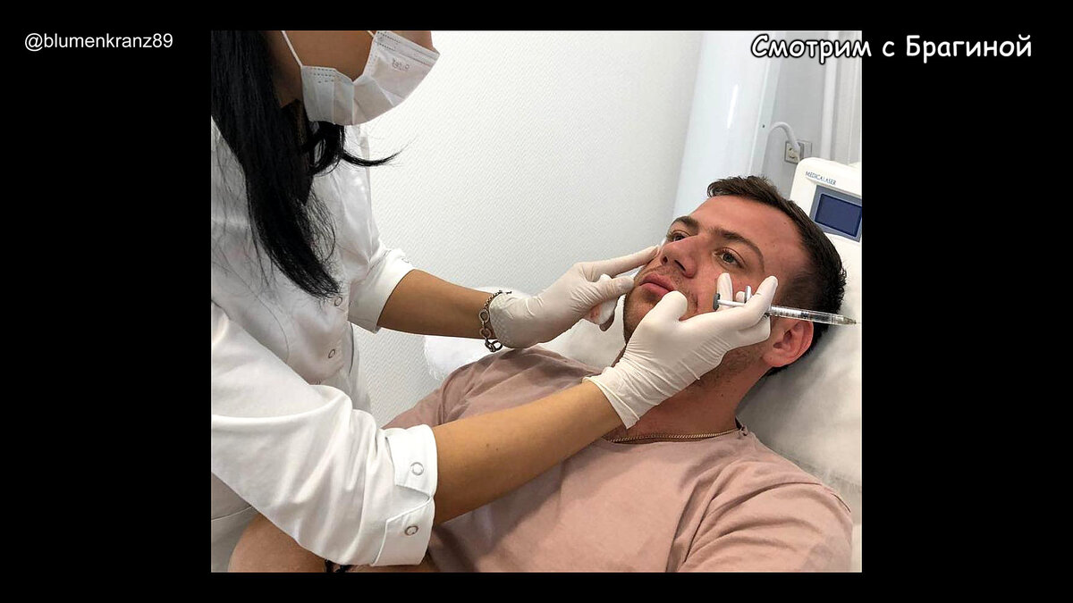 Валерий Блюменкранц колет филлеры, фото: Валерий Блюменкранц (@blumenkranz89)
