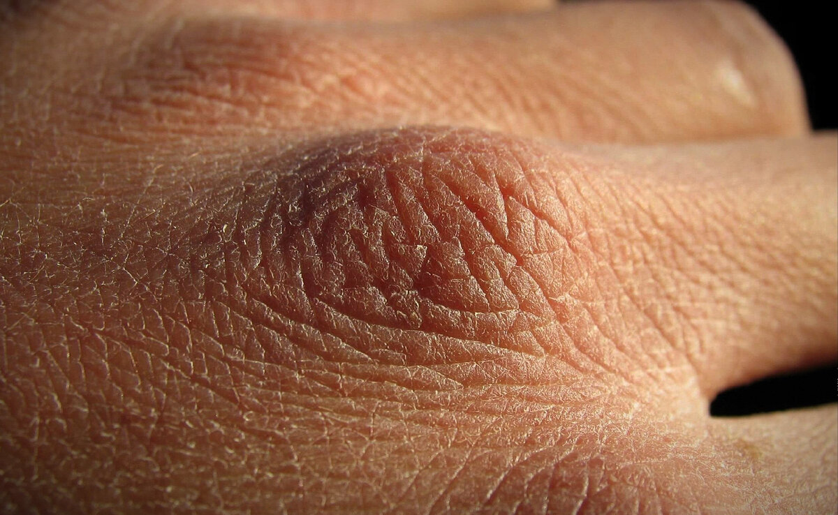 Состояние кожи