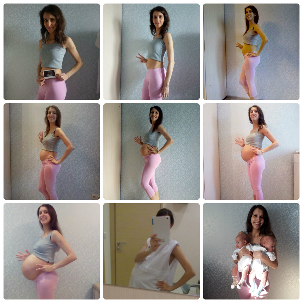 Моя беременность двойней