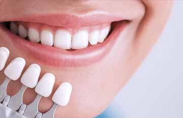 Статья - https://ed-m.ru/Poleznye-statqi/Protezirovanie/veneers-for-teeth