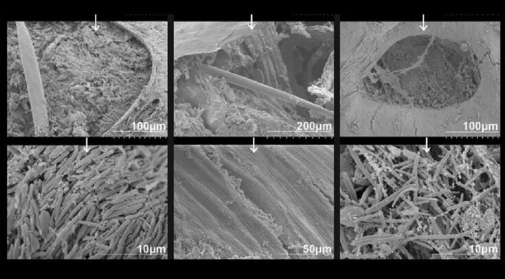     Электоронные микрофотографии фекалий мышей (слева направо): обычных, безмикробных и после пересадки кала Syed Mohammed Musheer Aalam et al. / Scientific Reports, 2022