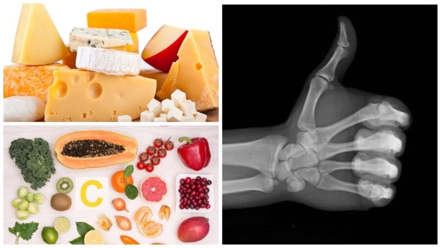 Что нужно есть при переломе. Продукты для костной ткани. Питание для костей. Витамины полезные для костей. Продукты дляукрепления крстей.