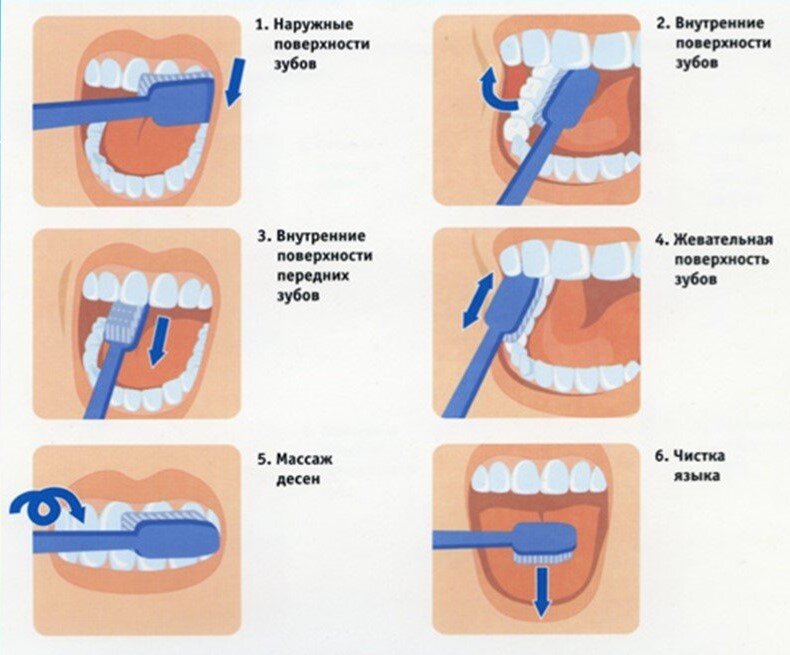 Схема чистки зубов для детей в картинках