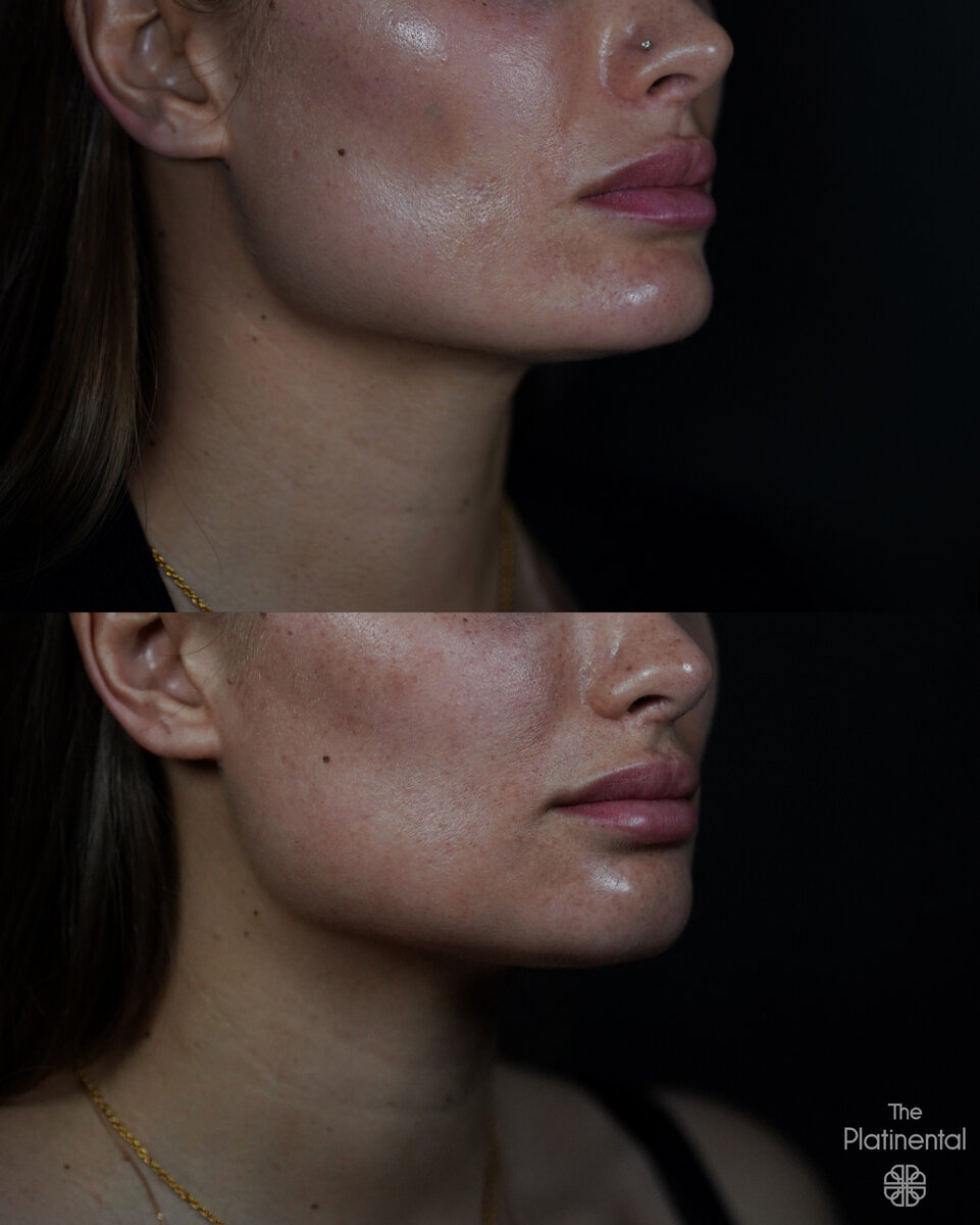 Хирург: Вахид Мамедов.