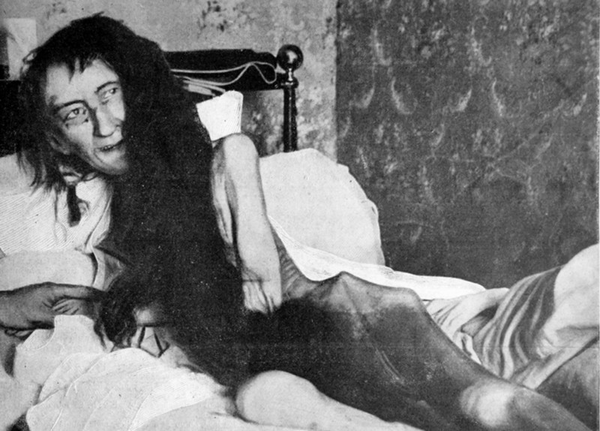 Blanche Monnier la scurt timp după ce a fost găsită &icirc;ntr-o cameră &icirc;ncuiată &icirc;n 1901 (Sursa: Wikimedia Commons)