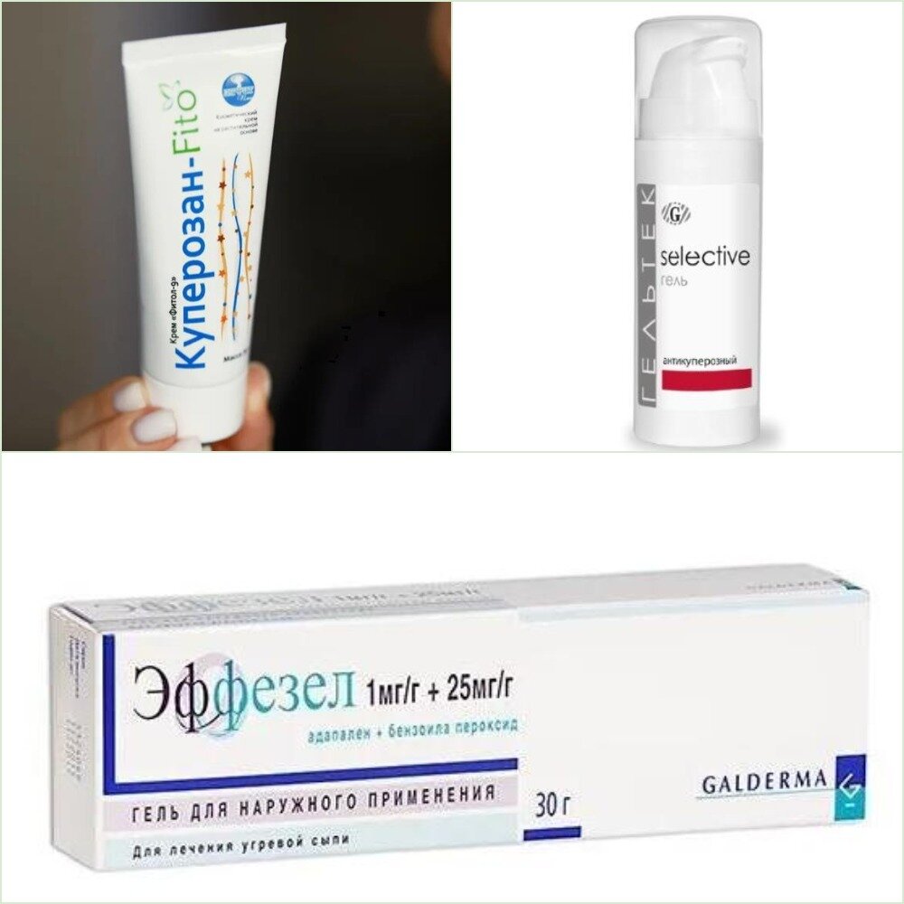 Боремся с poзaцeа (купepoз) в домашних условиях и у косметолога, что ...