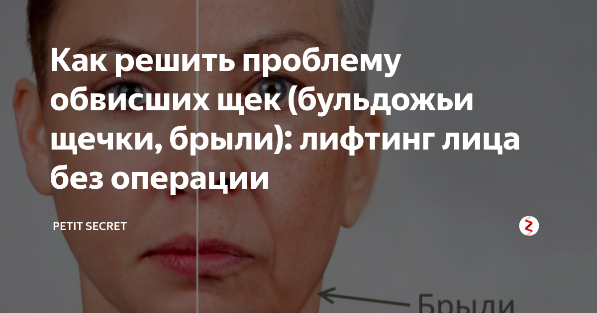 Как убрать бульдожьи щечки на лице. Бульдожьи щечки. Брыли схема. Упражнения для подтяжки лица от бульдожьих щечек. Гимнастика для лица от бульдожьих щечек.