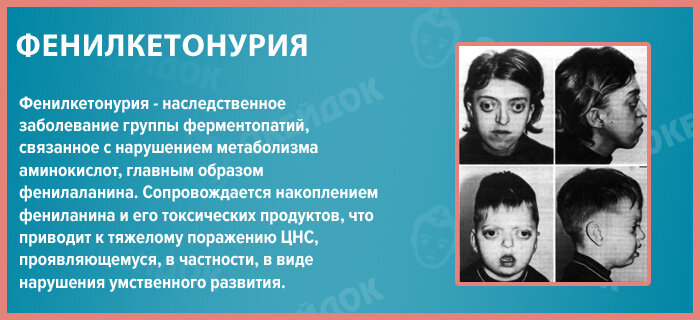Фенилкетонурия это наследственное заболевание. Фенилкетонурия это генное заболевание. Фенилкетонурия тип наследственности. Генные болезни фенилкетонурия. Фенилкетонурия ген регулятор.