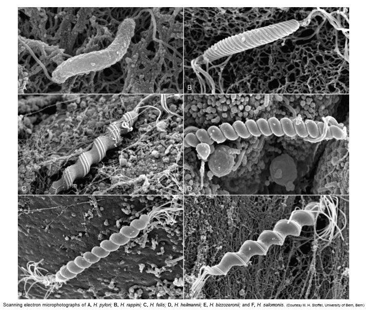  
         Представители рода Helicobacter: (A) H.pylory, (B) H. rappini, (C) H. felis, (D) H. heilmannii, (E) H. bizzozeronii, (F) H. salomonis
 