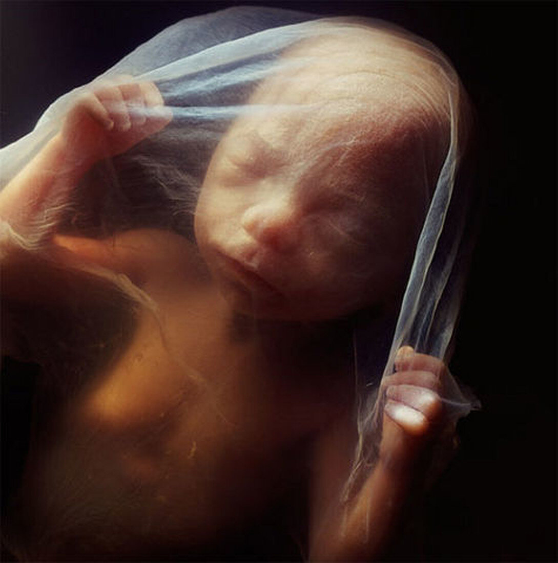 Эмбрион 18 недель Леннарт Нильссон 1965