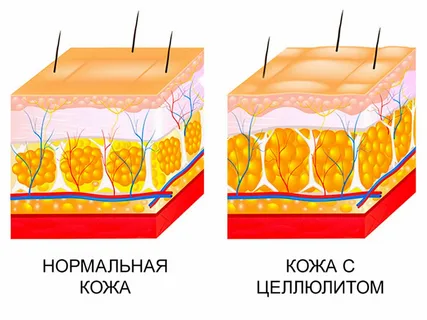 А вы пробовали ходить на четвереньках? Одно время это было очень популярное упражнение, которое можно было увидеть по сети, его предлагали делать многие.-2