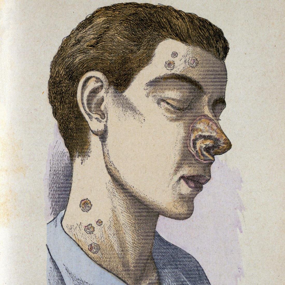 Где мой нос? Хороший вопрос