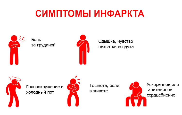 Инфаркт миокарда: признаки, симптомы сердечного приступа, лечение в ФНКЦ ФМБА