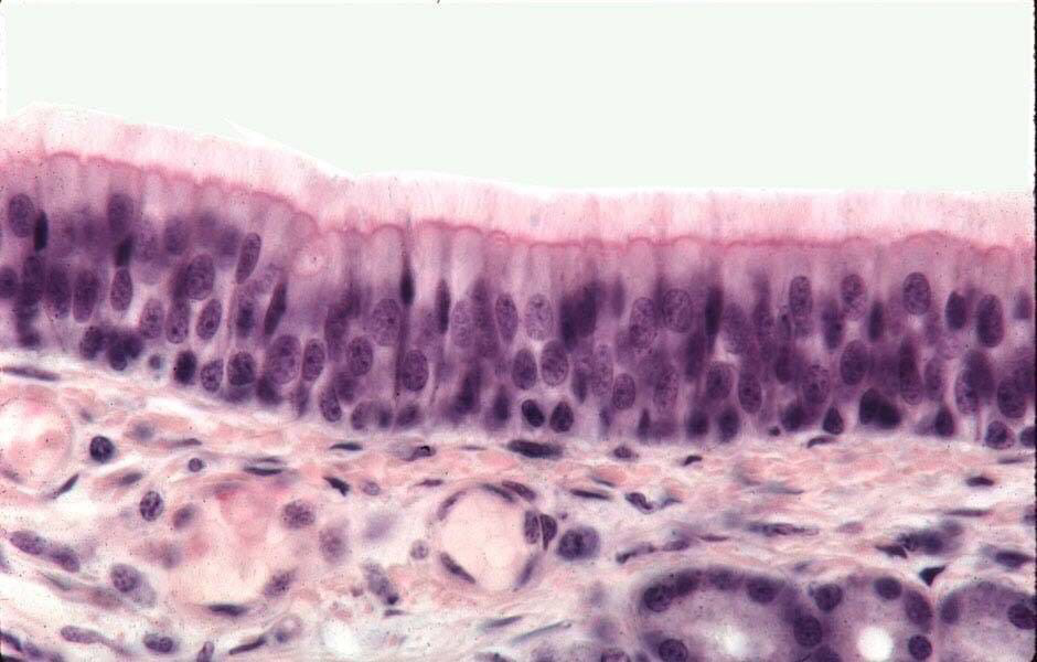 Многорядный реснитчатый мерцательный эпителий. Многорядным мерцательным. Многорядным мерцательным. Многоядерный мерцательный эпителий. Многорядный призматический мерцательный эпителий трахеи.
