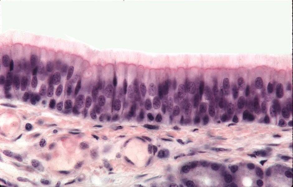 Односдойный многоядерный призматический ресгитчатый эпителий. Многорядный реснитчатый мерцательный эпителий трахеи. Однослойный многорядный призматический реснитчатый эпителий. Мерцательный эпителий гистология препарат.