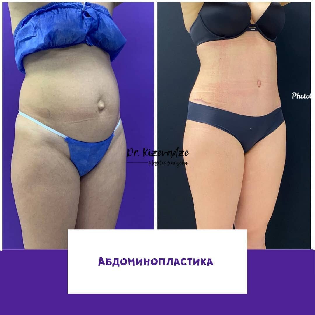 https://www.instagram.com/p/CK1f9nPlAQX/