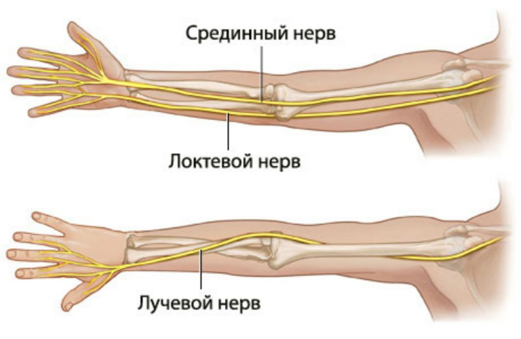 Невропатия нерва руки. Лучевой локтевой нерв защемление. Локтевой нерв в локтевом суставе. Срединный локтевой лучевой нерв анатомия. Неврит невропатия локтевого срединного лучевого нерва.