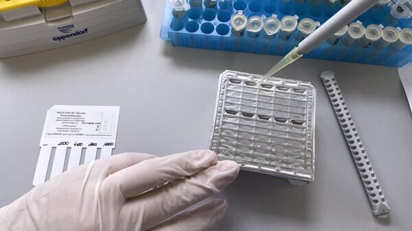    Тест-система для выявления случаев заражения оспой обезьян, созданная государственным научным центром "Вектор" © РИА Новости / Пресс-служба научного центра вирусологии и биотехнологий "Вектор"